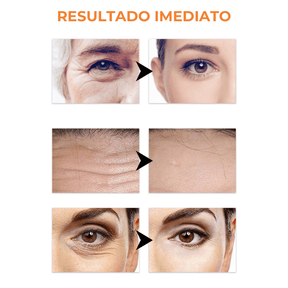 Collagen Skin Mask™ - Colágeno + Ácido Hialurônico +BRINDE