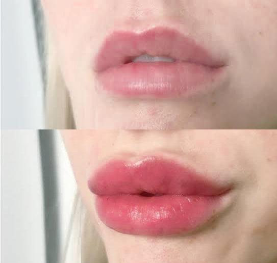 Gloss Labial Baby-Lips