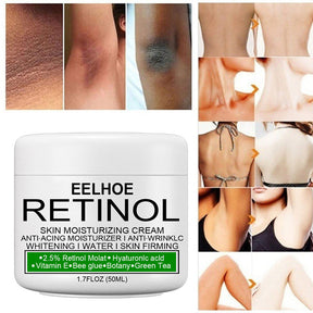 Retinou™ Creme Para Clareamento, Retire a Manchas Excessivas de Qualquer Região