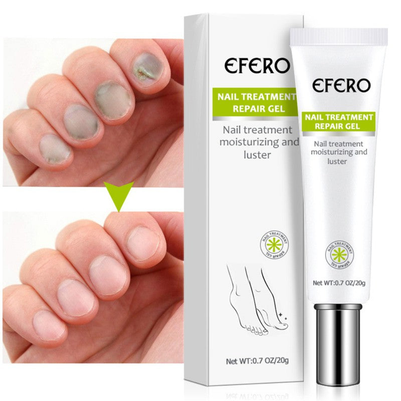 Efero Cream - Creme Anti-Inflamatório Para Remoção de Fungos