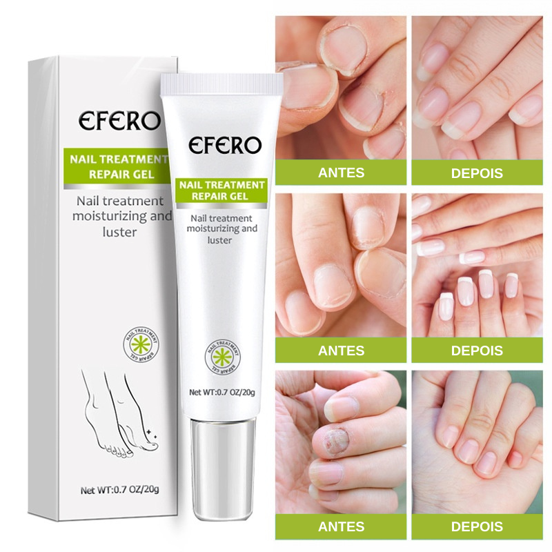 Efero Cream - Creme Para Remoção de Fungos