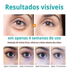 Creme Antifadiga para Área dos Olhos – Revitalize