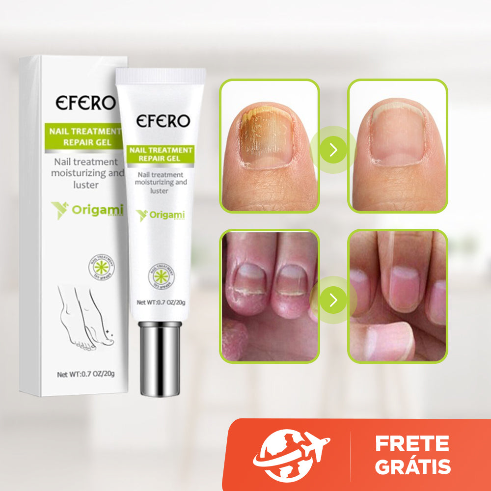 Efero Cream - Creme Anti-Inflamatório Para Remoção de Fungos