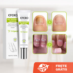 Efero Cream - Creme Anti-Inflamatório Para Remoção de Fungos