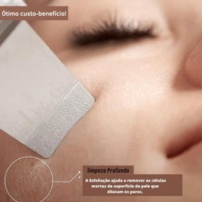 Aparelho Peeling Ultrassônico Limpeza Facial – Pele Radiante