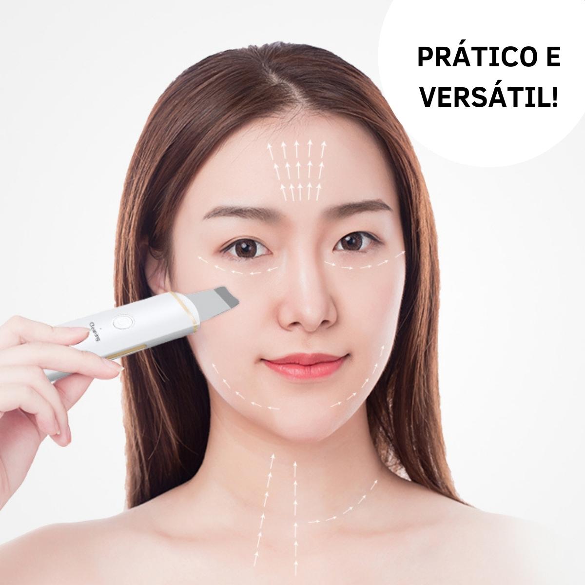 Aparelho Peeling Ultrassônico Limpeza Facial – Pele Radiante