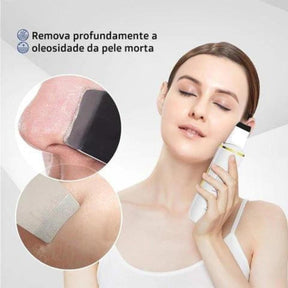 Aparelho Peeling Ultrassônico Limpeza Facial – Pele Radiante