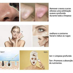 Aparelho Peeling Ultrassônico Limpeza Facial – Pele Radiante