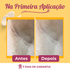 Retinou™ Creme Para Clareamento, Retire a Manchas Excessivas de Qualquer Região