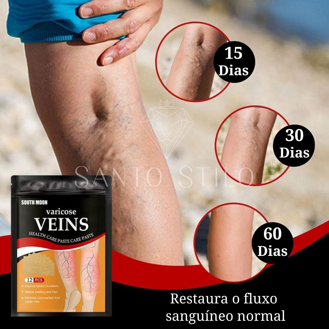 Adesivo removedor de Varizes – Varicose Veins