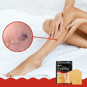 Adesivo removedor de Varizes – Varicose Veins