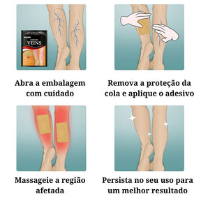 Adesivo removedor de Varizes – Varicose Veins