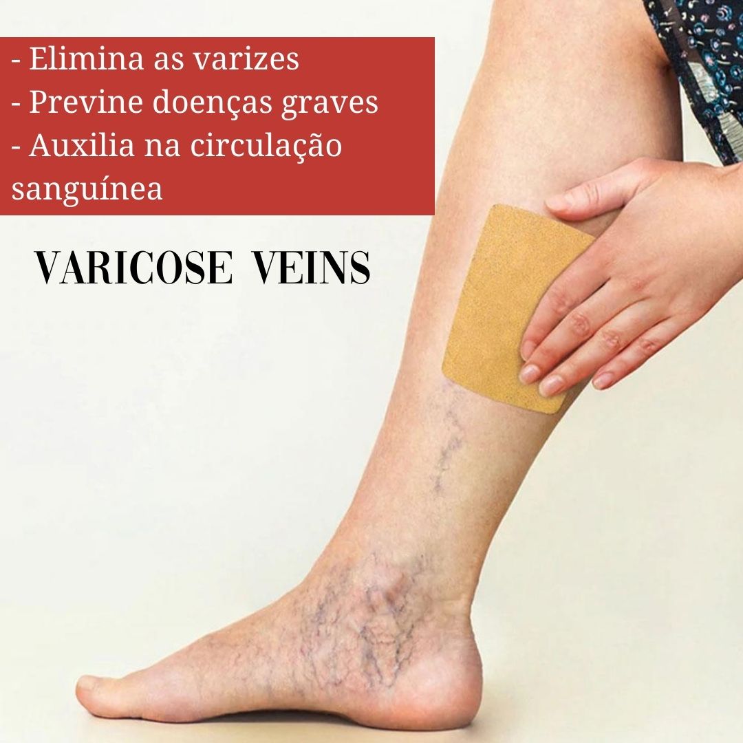 Adesivo removedor de Varizes – Varicose Veins