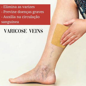 Adesivo removedor de Varizes – Varicose Veins