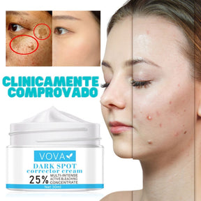 Creme para Melasma - Melaslow