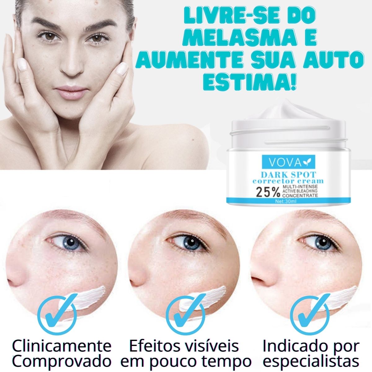 Creme para Melasma - Melaslow