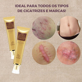 Gel Removedor de Cicatriz e Clareador de Manchas - Perfect Skin + Brinde