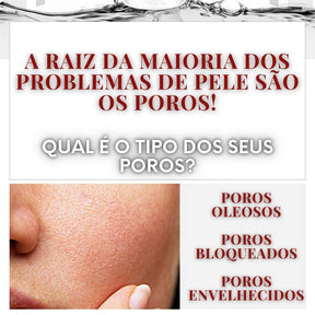 Sérum Redutor de Poros e Oleosidade – Poreless