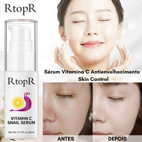 Sérum Vitamina C Antienvelhecimento - Skin Control